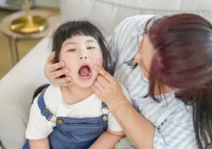 Do Cavities in Baby Teeth Need to Be Filled?