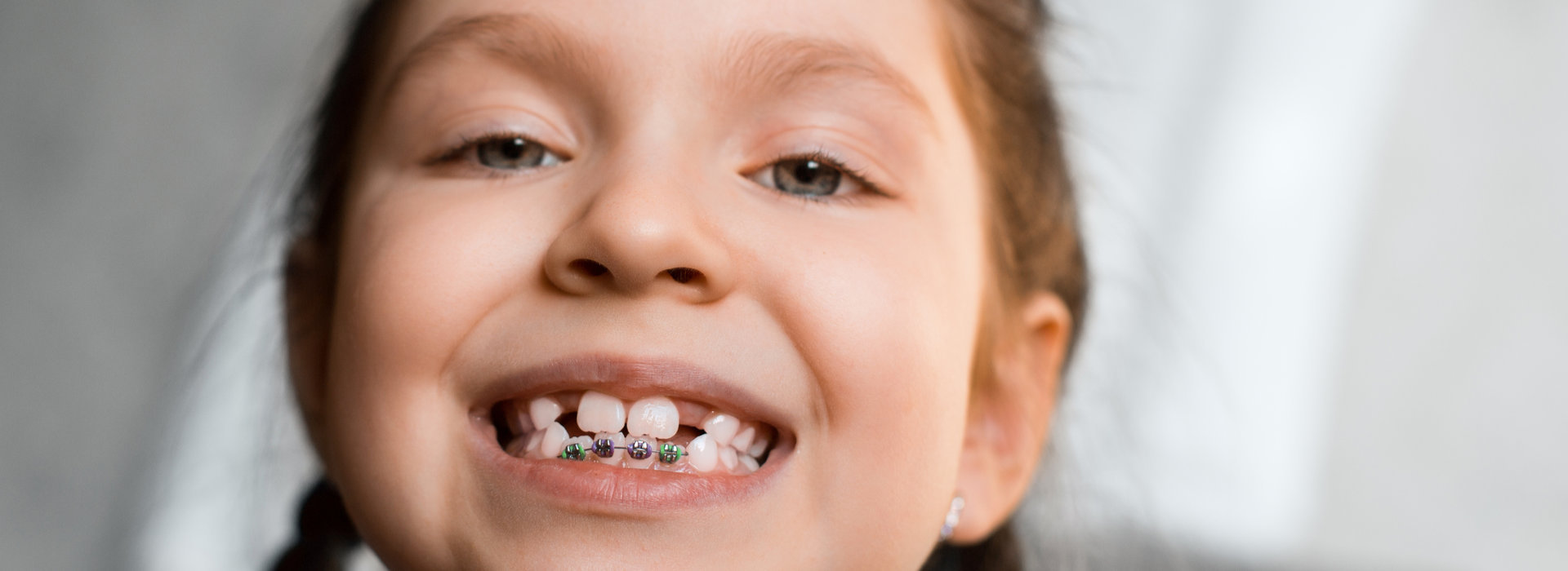 South OC Pediatric Dentistry & Orthodontics - Blog