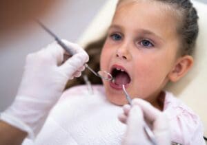 5 Simple Ways Parents Can Help Prevent Cavities in Young Children