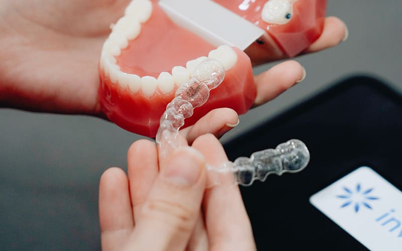 Invisalign