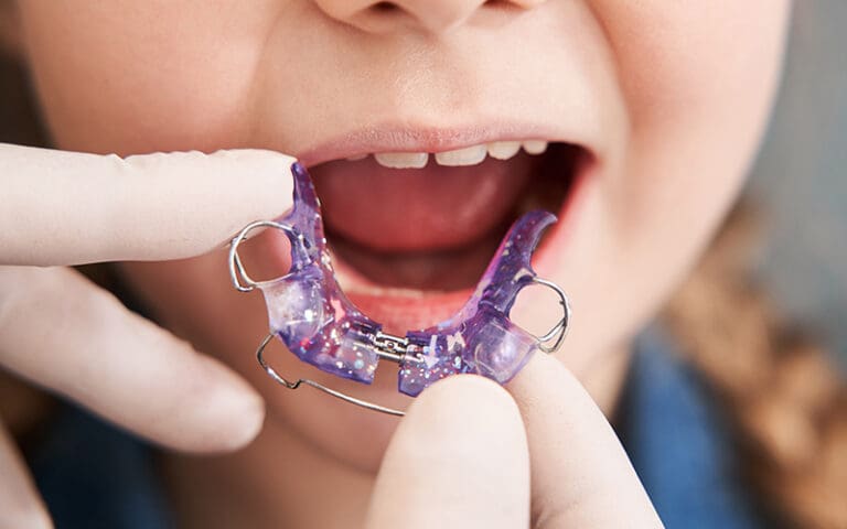 A girl receiving a mouth appliance